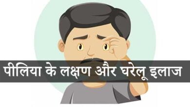 पीलिया के लक्षण और घरेलू इलाज