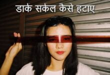 Dark circle kaise hataye in Hindi
