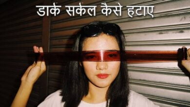 Dark circle kaise hataye in Hindi
